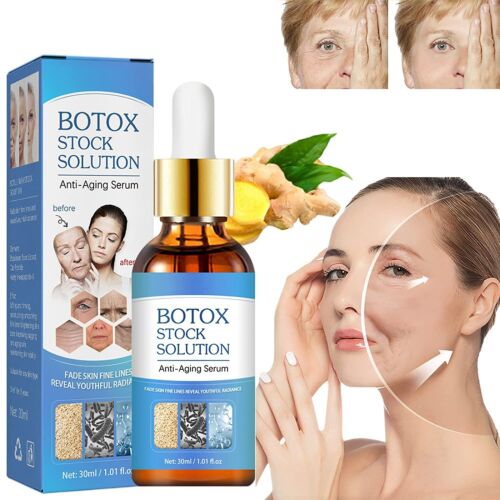 Botox Antienvejecimiento