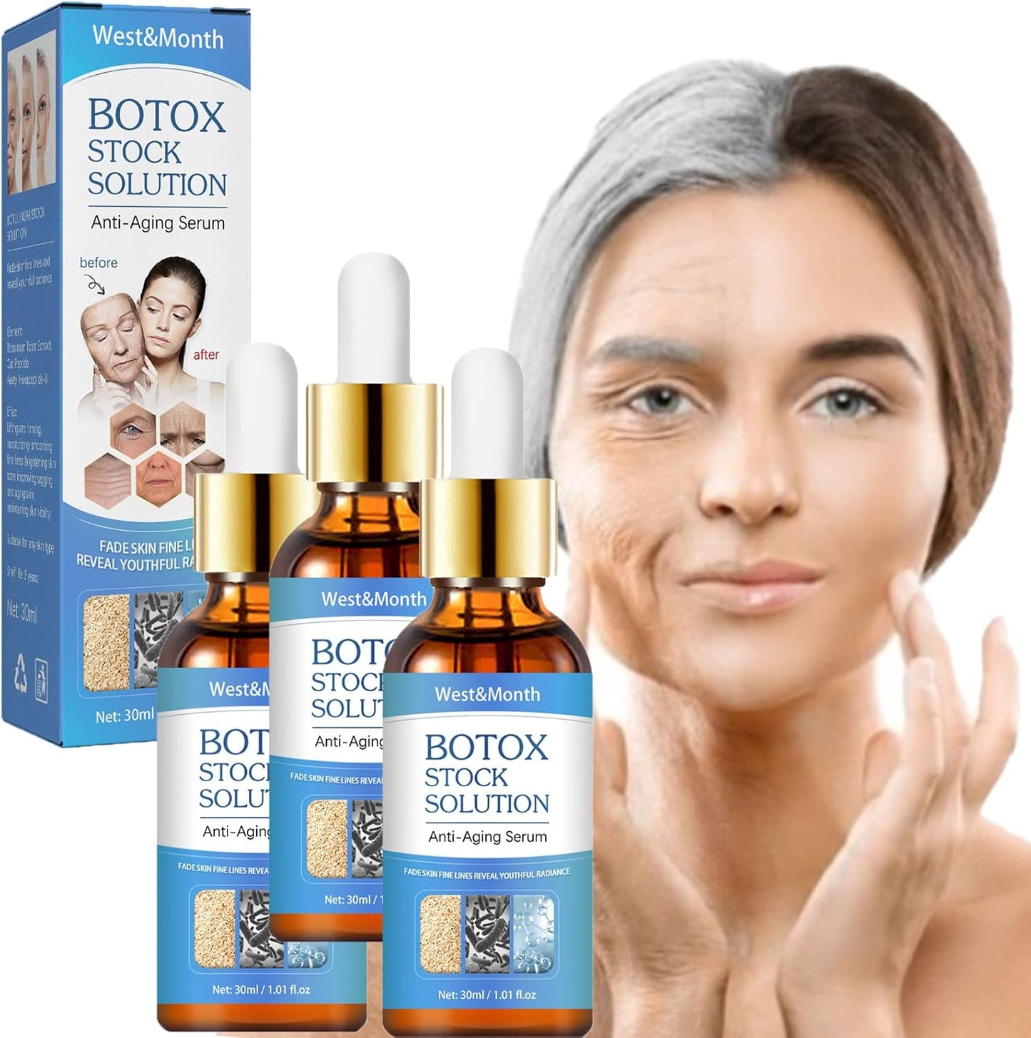 Botox Antienvejecimiento