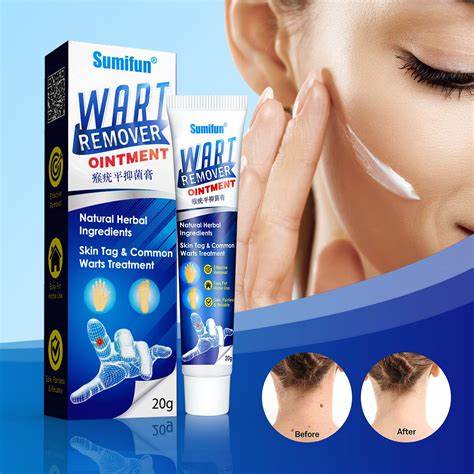 Crema Wart Remover